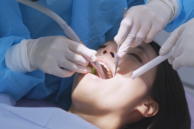 Best Root Canal Treatment Singapore