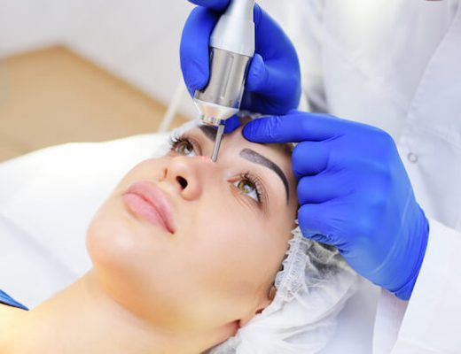Best Laser Acne Removal Singapore