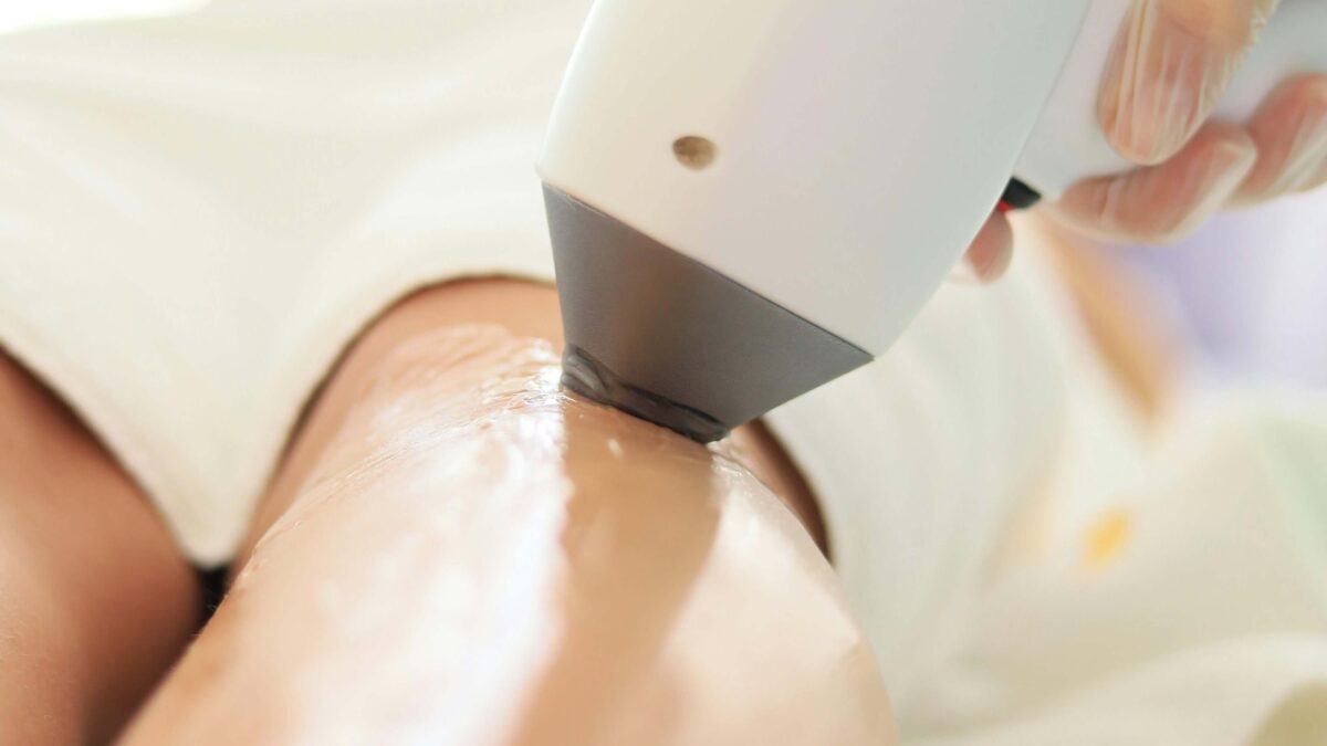 Smooth Girl Season: 10 SHR Leg Hair Removal In SG