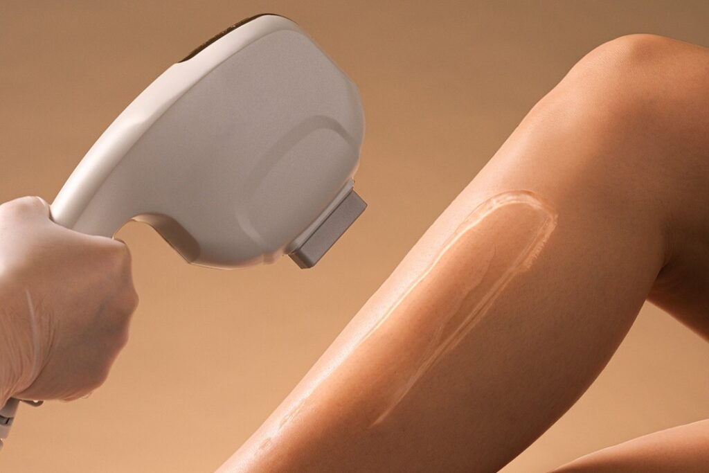 Strip SHR Hair Removal Singapore